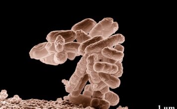 Co jest potrzebne do sterylizacji?